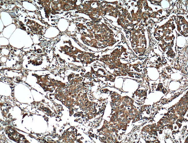 RPL3 Antibody in Immunohistochemistry (Paraffin) (IHC (P))