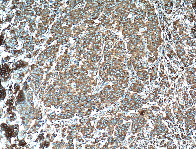 RPL3 Antibody in Immunohistochemistry (Paraffin) (IHC (P))