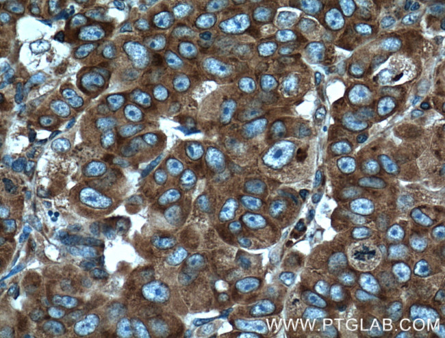 RPL3 Antibody in Immunohistochemistry (Paraffin) (IHC (P))