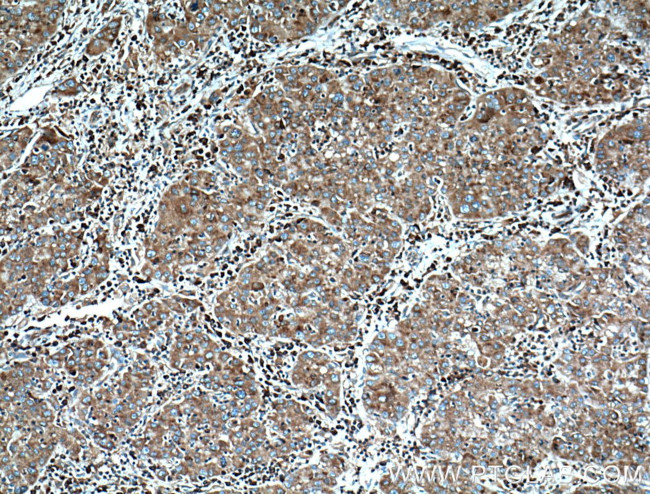 RPL3 Antibody in Immunohistochemistry (Paraffin) (IHC (P))