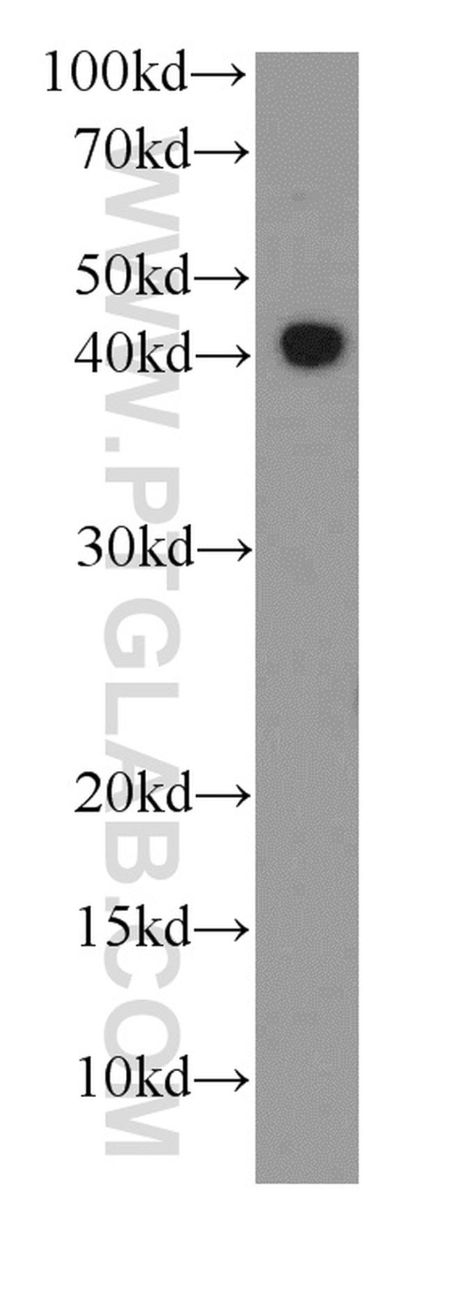 RPL3 Antibody in Western Blot (WB)