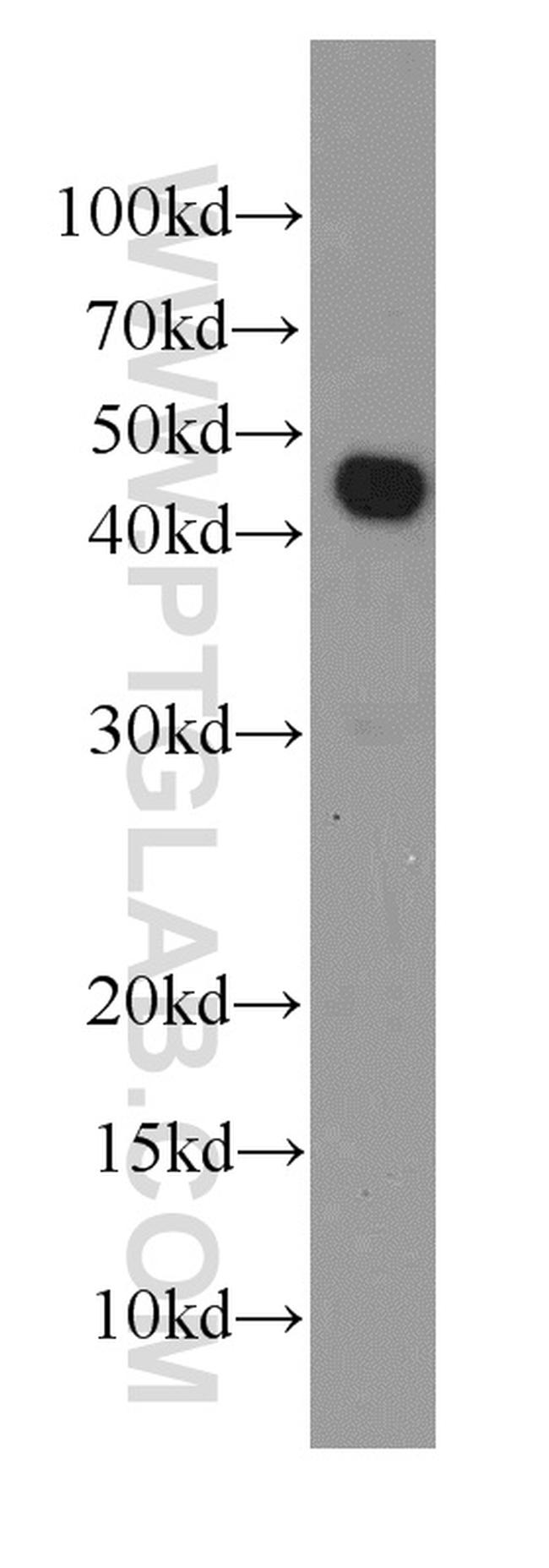 RPL3 Antibody in Western Blot (WB)