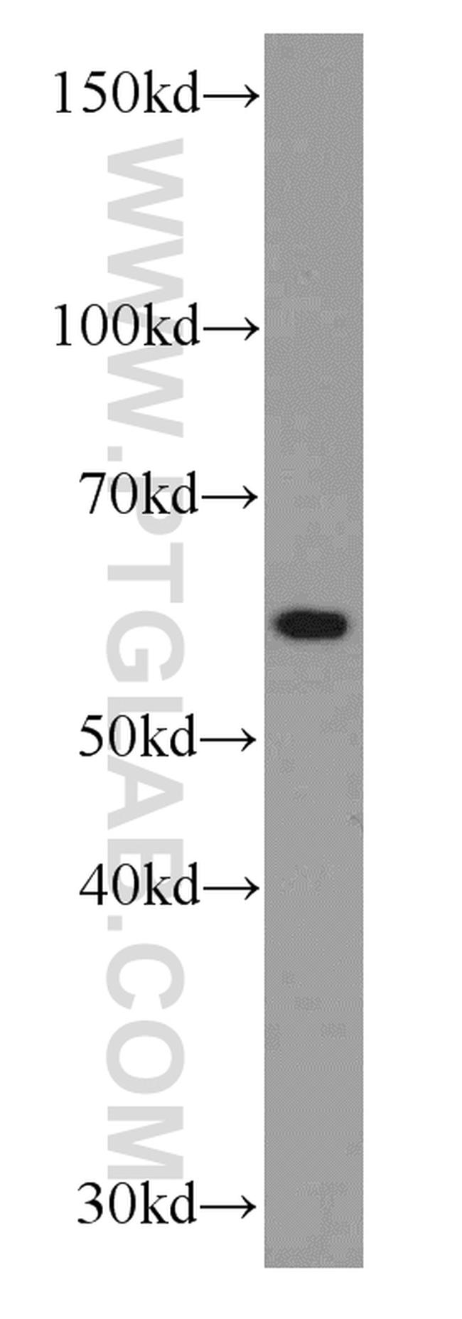 RBPJ Antibody in Western Blot (WB)