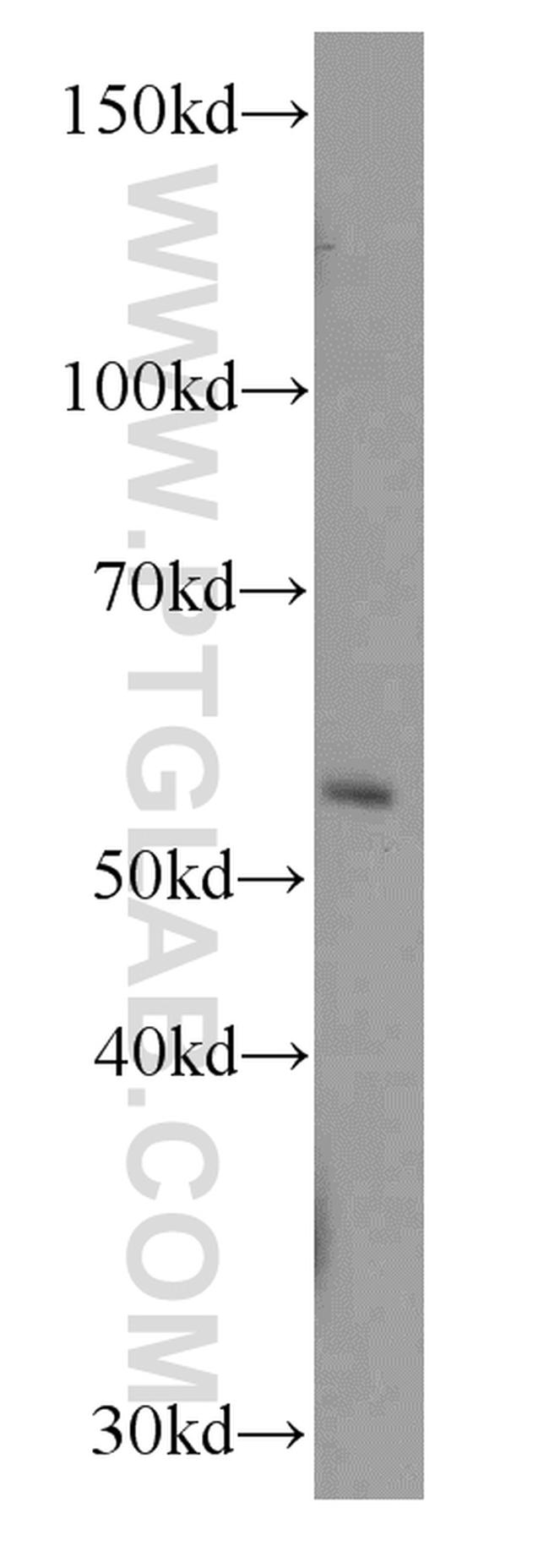 RBPJ Antibody in Western Blot (WB)