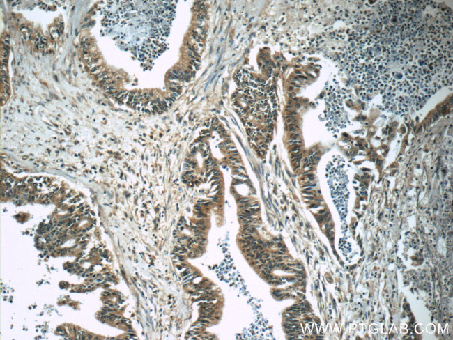 Amylase alpha Antibody in Immunohistochemistry (Paraffin) (IHC (P))