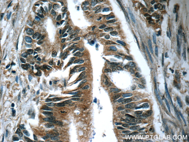 Amylase alpha Antibody in Immunohistochemistry (Paraffin) (IHC (P))