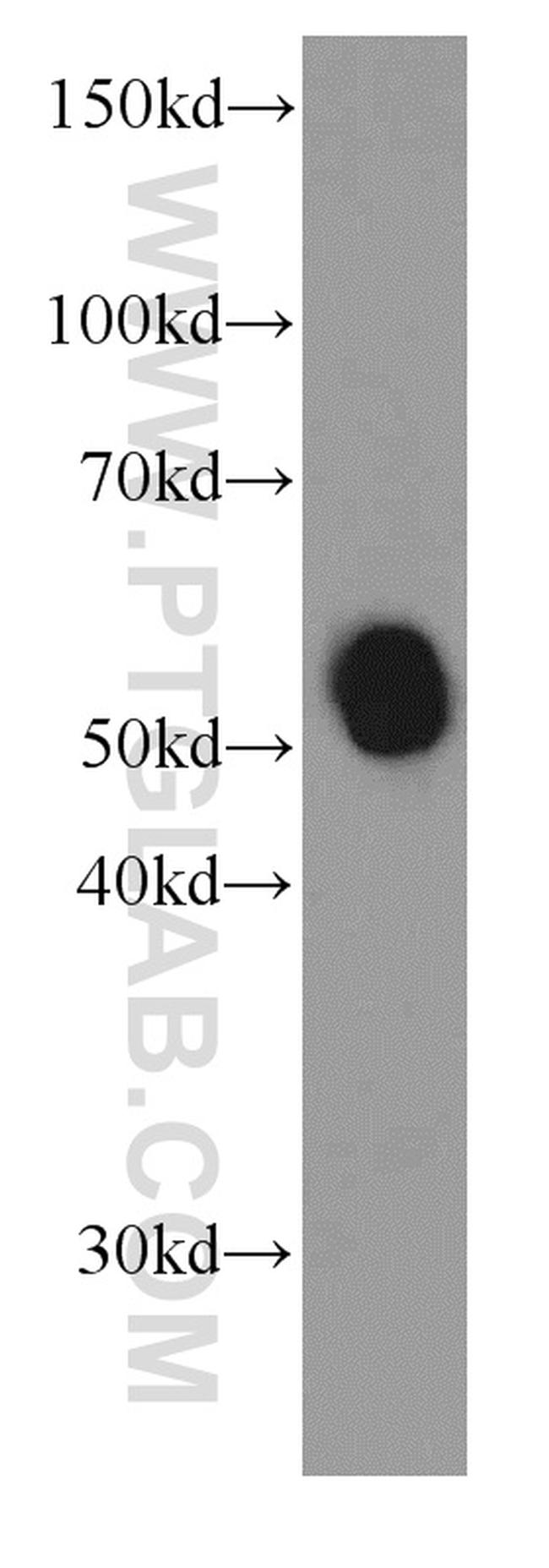 Amylase alpha Antibody in Western Blot (WB)