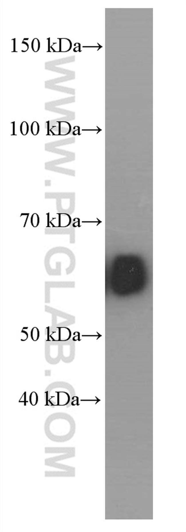 Amylase alpha Antibody in Western Blot (WB)