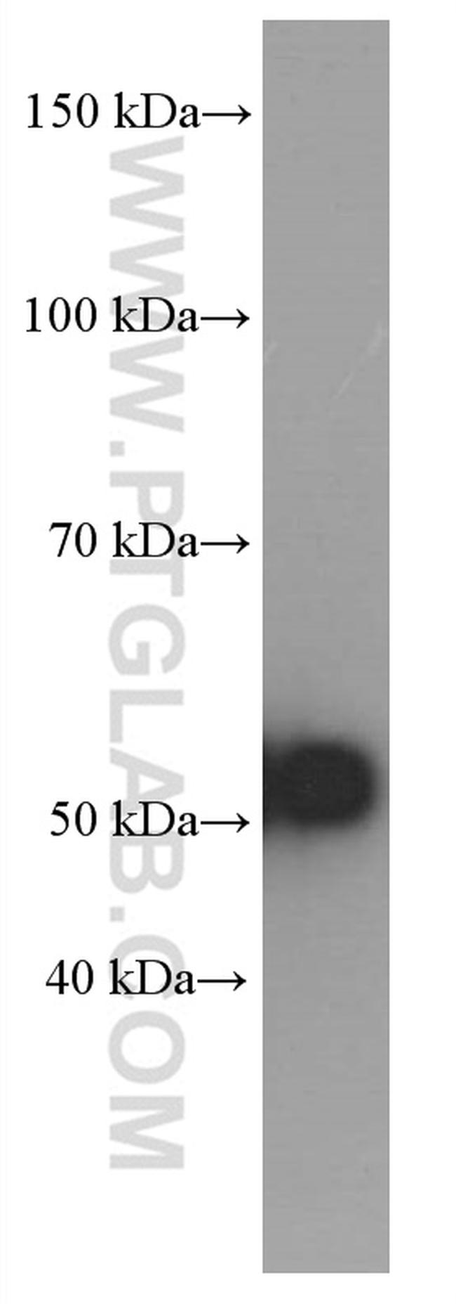 Amylase alpha Antibody in Western Blot (WB)