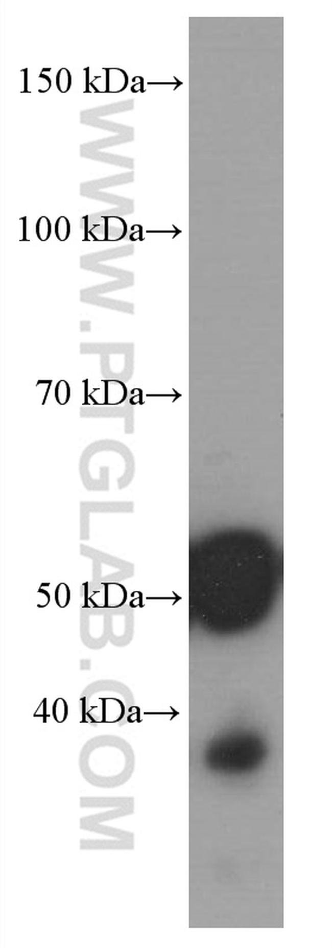 Amylase alpha Antibody in Western Blot (WB)