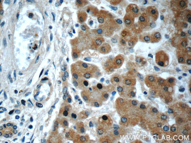 GOSR2/Membrin Antibody in Immunohistochemistry (Paraffin) (IHC (P))