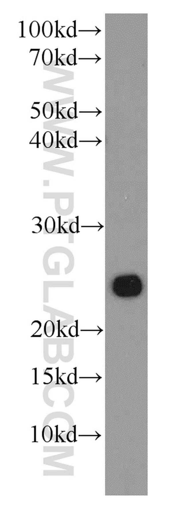 GOSR2/Membrin Antibody in Western Blot (WB)