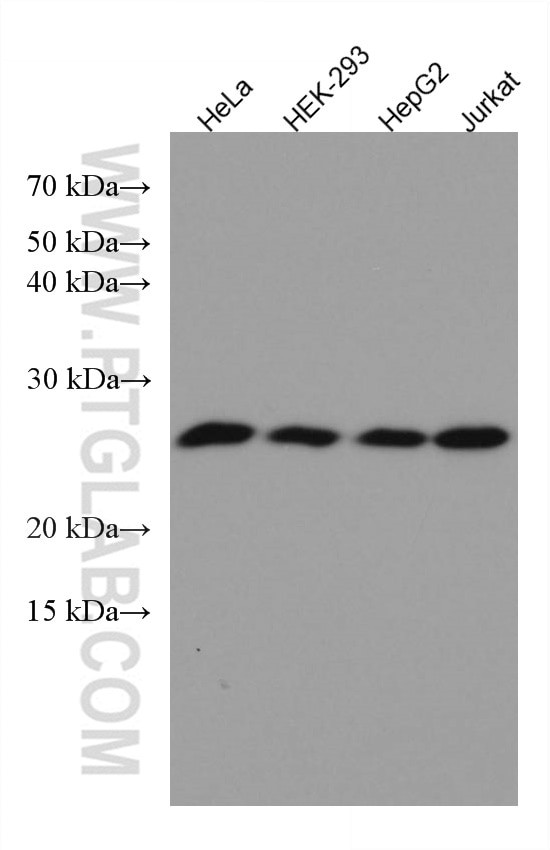 GOSR2/Membrin Antibody in Western Blot (WB)