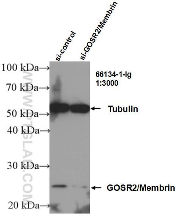 GOSR2/Membrin Antibody in Western Blot (WB)