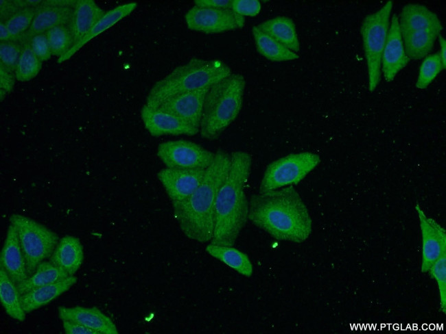 Alpha-1-Antitrypsin Antibody in Immunocytochemistry (ICC/IF)