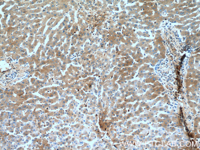 Alpha-1-Antitrypsin Antibody in Immunohistochemistry (Paraffin) (IHC (P))