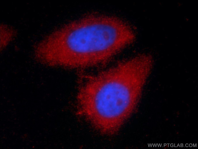 Alpha-1-Antitrypsin Antibody in Immunocytochemistry (ICC/IF)