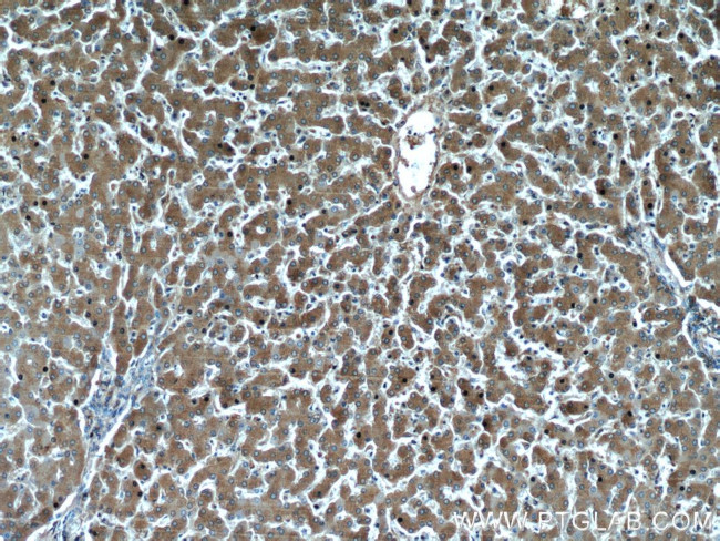 Alpha-1-Antitrypsin Antibody in Immunohistochemistry (Paraffin) (IHC (P))