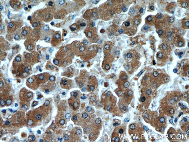 Alpha-1-Antitrypsin Antibody in Immunohistochemistry (Paraffin) (IHC (P))