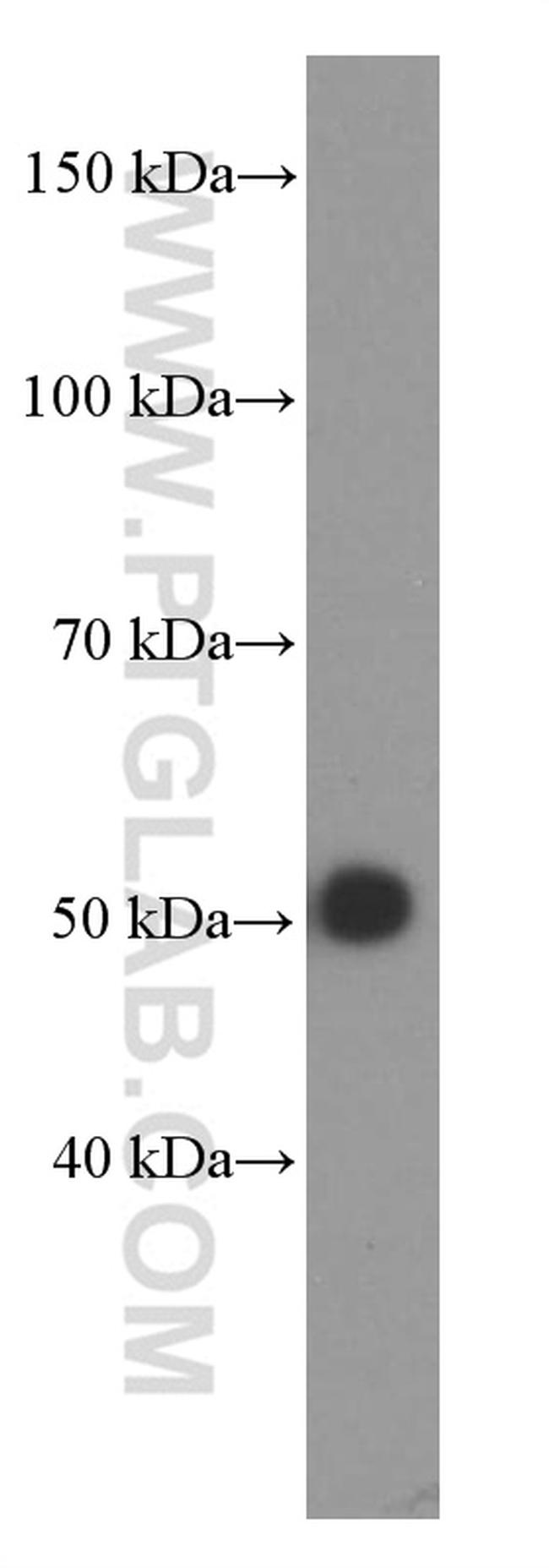 Alpha-1-Antitrypsin Antibody in Western Blot (WB)