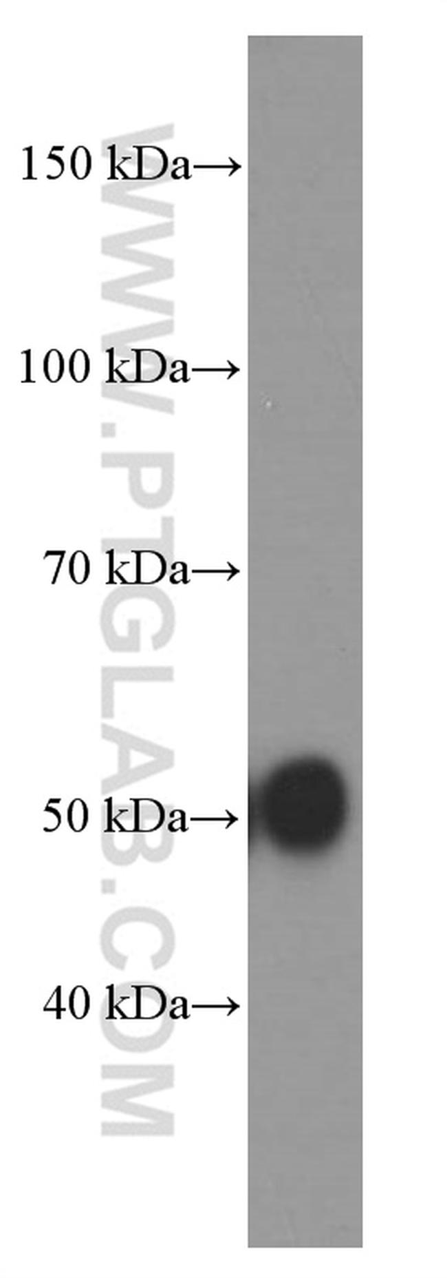 Alpha-1-Antitrypsin Antibody in Western Blot (WB)