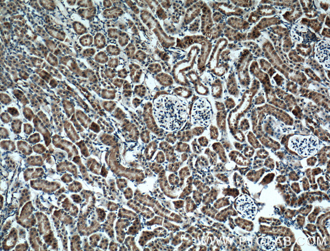 BBS5 Antibody in Immunohistochemistry (Paraffin) (IHC (P))