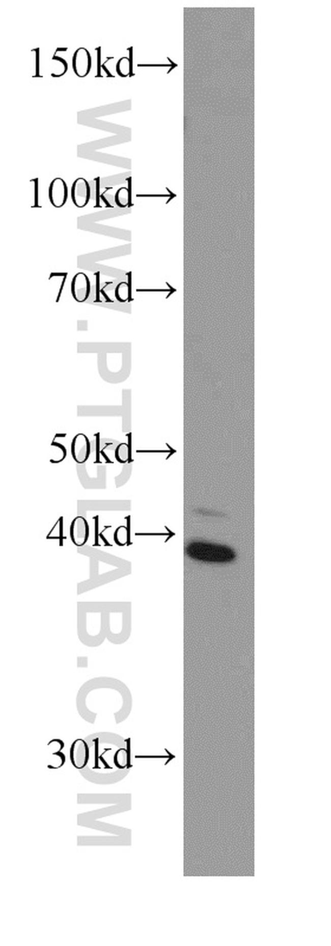 BBS5 Antibody in Western Blot (WB)