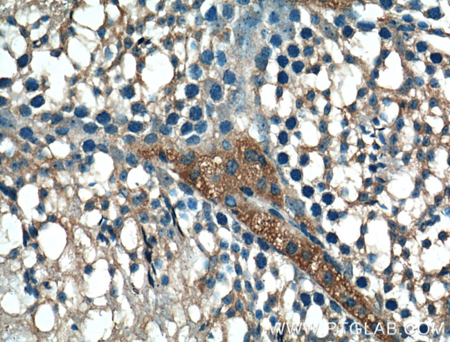 BBS5 Antibody in Immunohistochemistry (Paraffin) (IHC (P))