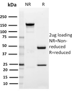 SIGLEC1/CD169/Sialoadhesin Antibody in SDS-PAGE (SDS-PAGE)