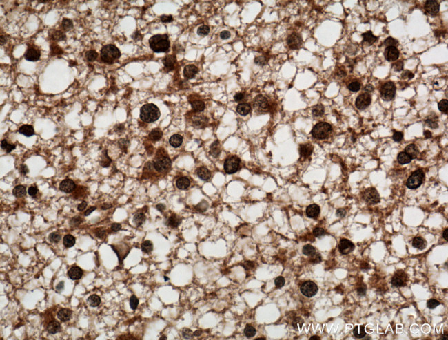 C9orf72 Antibody in Immunohistochemistry (Paraffin) (IHC (P))