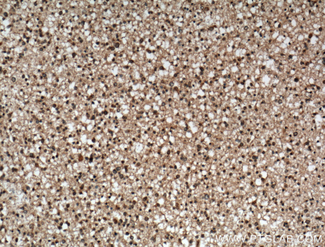 C9orf72 Antibody in Immunohistochemistry (Paraffin) (IHC (P))