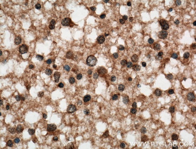 C9orf72 Antibody in Immunohistochemistry (Paraffin) (IHC (P))