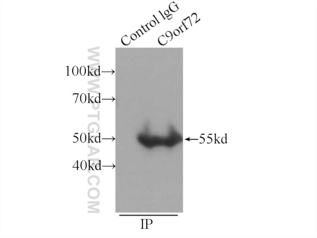 C9orf72 Antibody in Immunoprecipitation (IP)