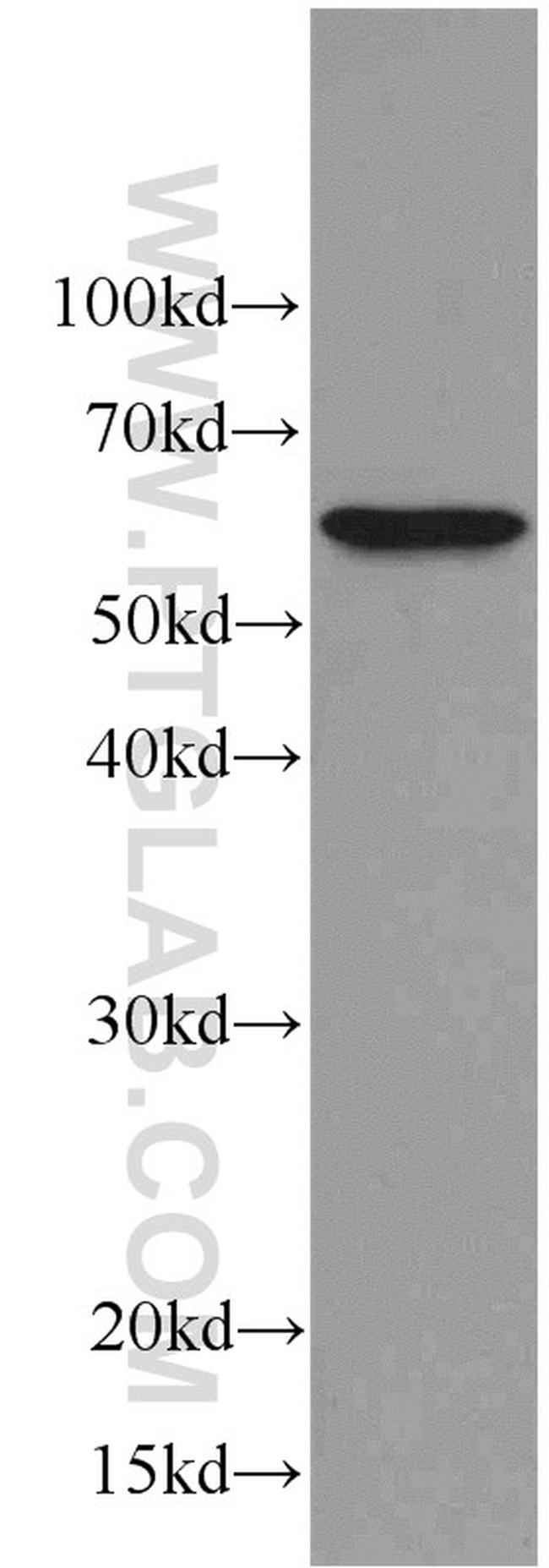 C9orf72 Antibody in Western Blot (WB)