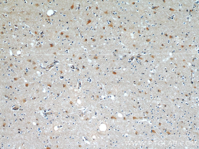 C9orf72 Antibody in Immunohistochemistry (Paraffin) (IHC (P))