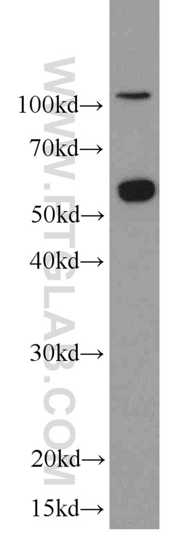 C9orf72 Antibody in Western Blot (WB)