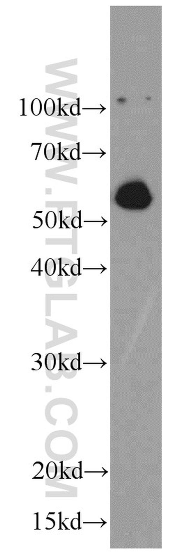 C9orf72 Antibody in Western Blot (WB)