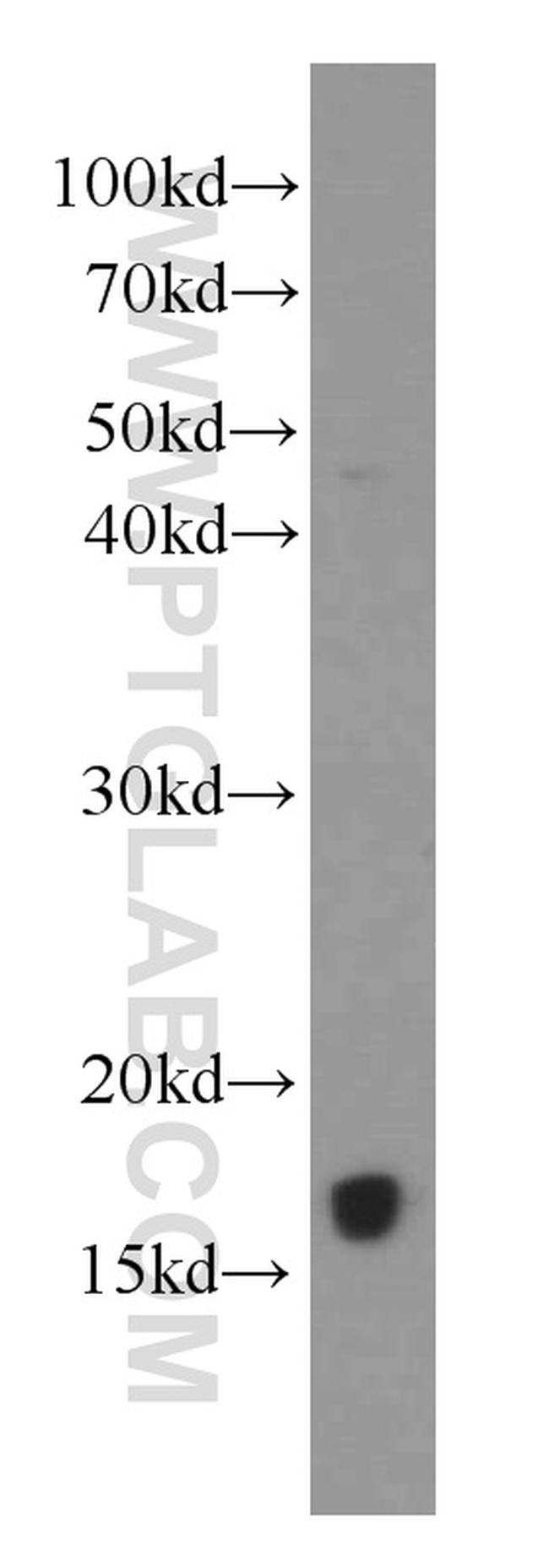 IL-4 Antibody in Western Blot (WB)