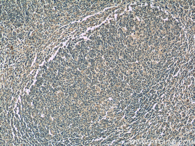 IL9 Antibody in Immunohistochemistry (Paraffin) (IHC (P))