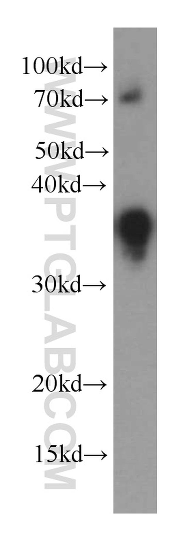 IL-16 Antibody in Western Blot (WB)