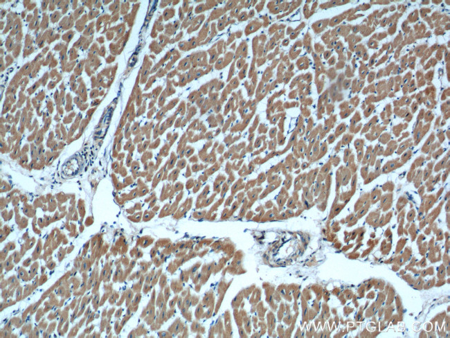 IL-6 Antibody in Immunohistochemistry (Paraffin) (IHC (P))