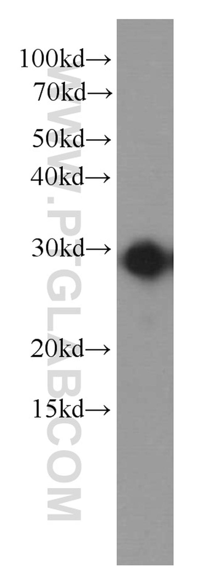 IL-6 Antibody in Western Blot (WB)