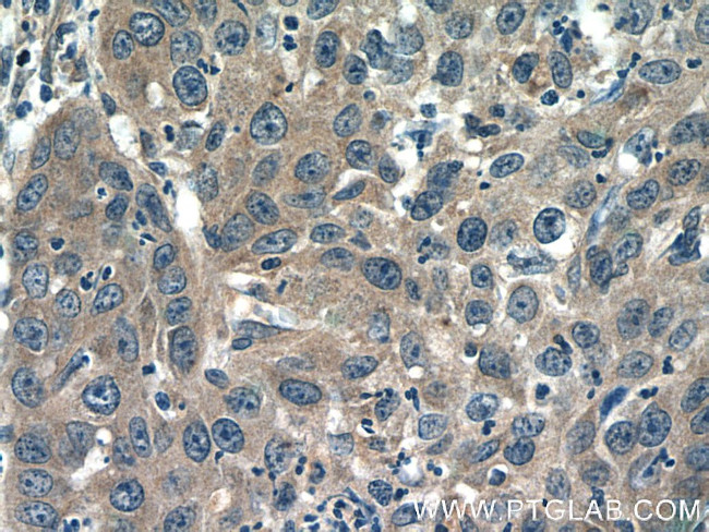 IL-6 Antibody in Immunohistochemistry (Paraffin) (IHC (P))