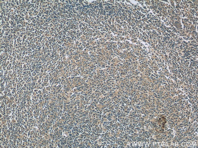 IL-6 Antibody in Immunohistochemistry (Paraffin) (IHC (P))