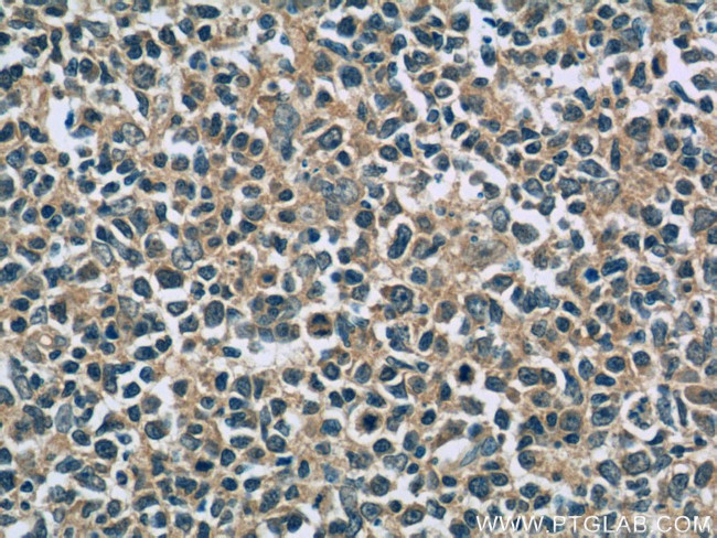 IL-6 Antibody in Immunohistochemistry (Paraffin) (IHC (P))