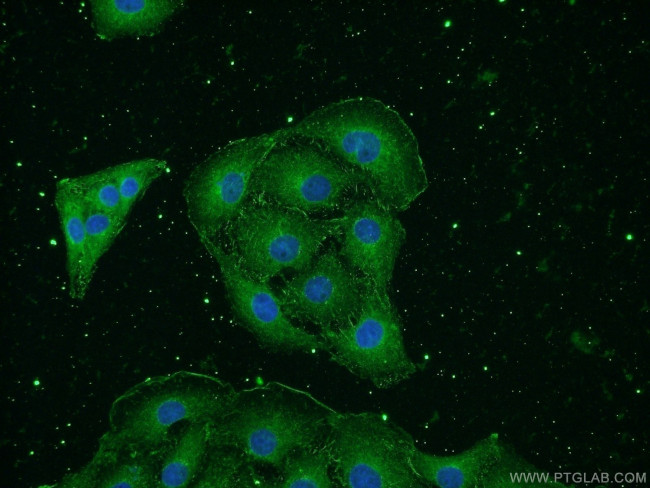 NSE Antibody in Immunocytochemistry (ICC/IF)