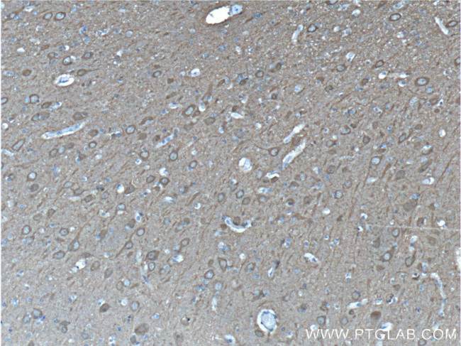 NSE Antibody in Immunohistochemistry (Paraffin) (IHC (P))