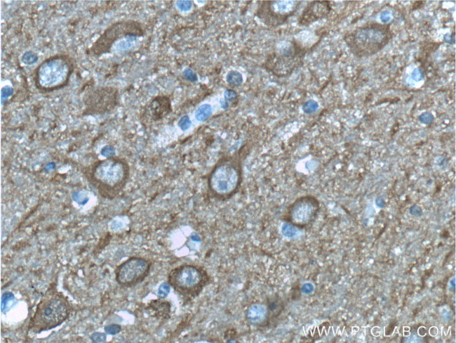 NSE Antibody in Immunohistochemistry (Paraffin) (IHC (P))