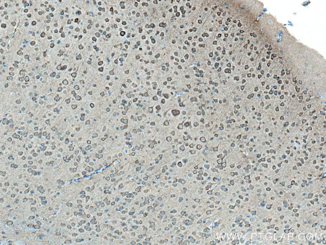 NSE Antibody in Immunohistochemistry (Paraffin) (IHC (P))