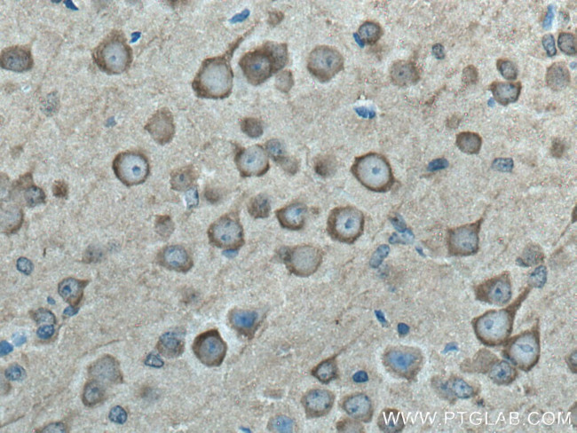 NSE Antibody in Immunohistochemistry (Paraffin) (IHC (P))